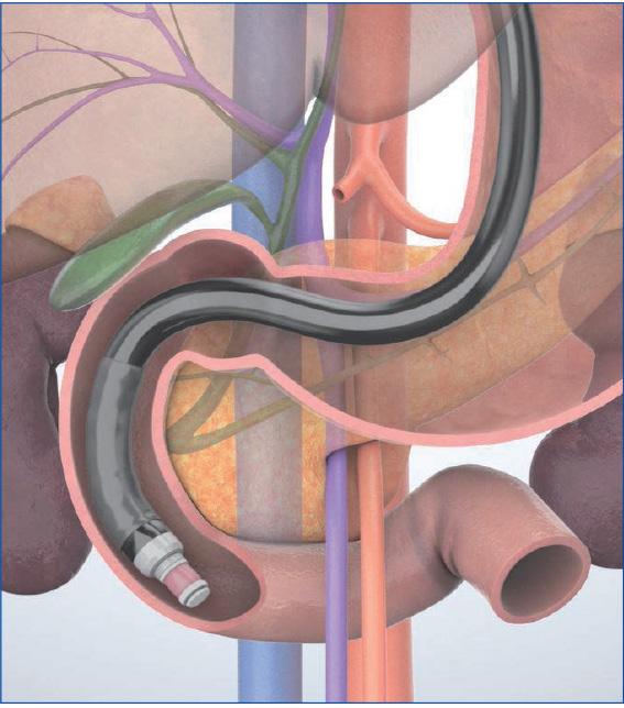 ラジアル走査式超音波内視鏡による膵・胆道領域の標準的描出法 