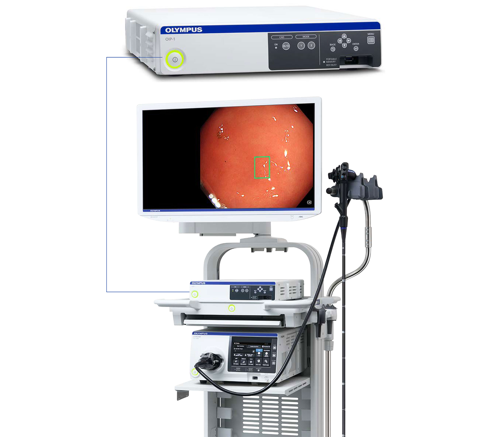 Endoscopy Cad System Oip 1 Endo Aid Intelligent Support For Future